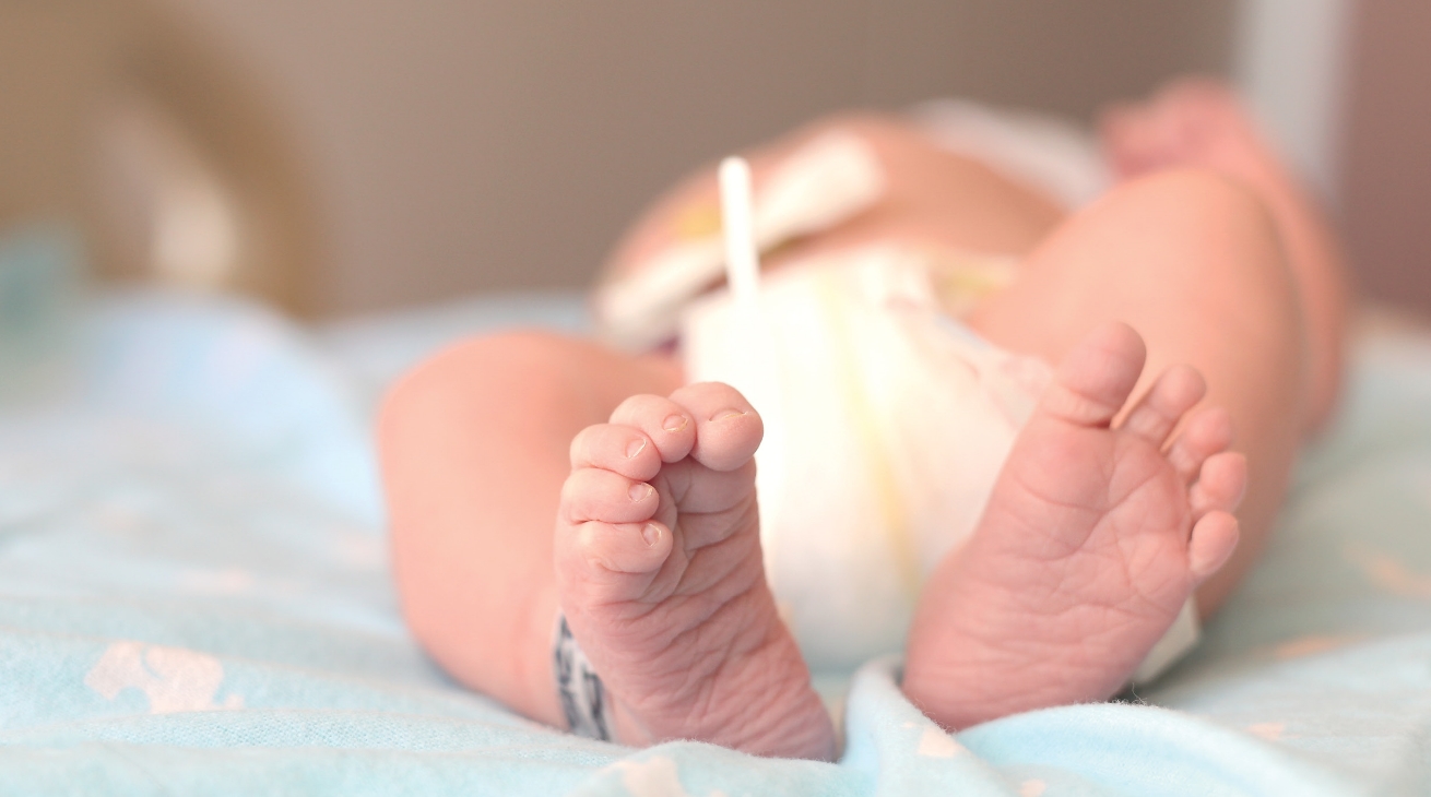 Hip dysplasia explained