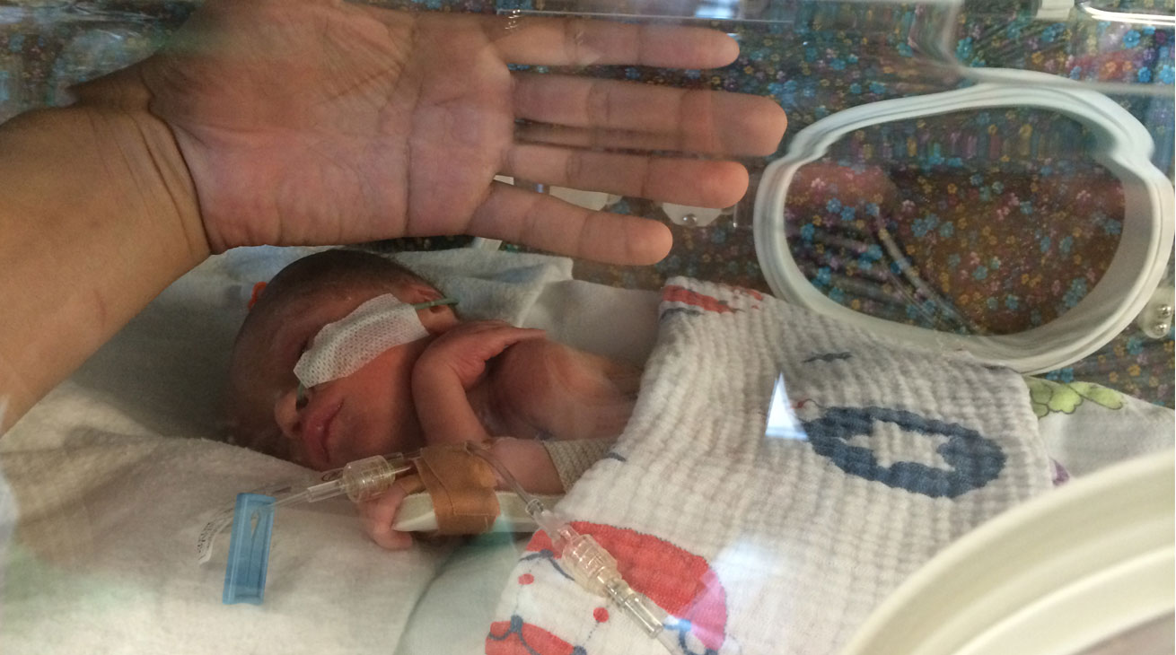 Premature birth: the trauma of separation