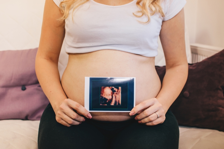 Antenatal Screening and Diagnostic Tests